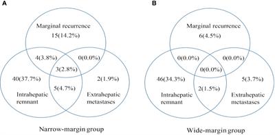 Narrow-Margin Hepatectomy Resulted in Higher Recurrence and Lower Overall Survival for R0 Resection Hepatocellular Carcinoma